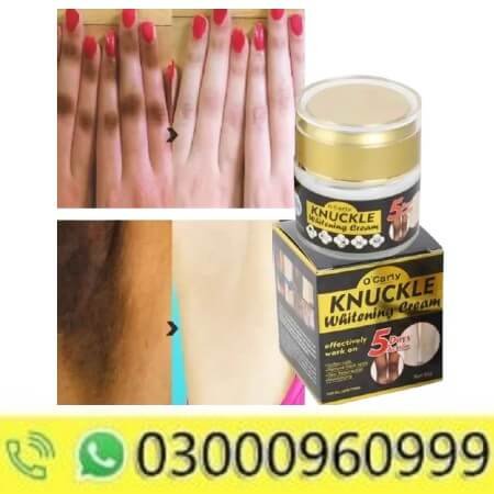 O'Carly Knuckle Whitening Cream In Pakistan